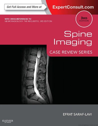 Spine Imaging: Case Review Series