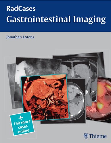 Radcases Gastrointestinal Imaging (Radcases Plus Q&A)