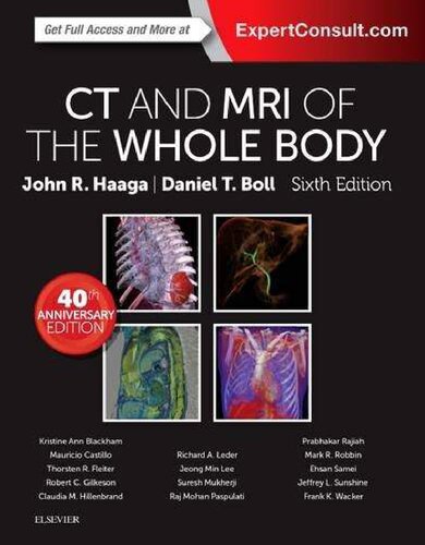 CT and MRI of the Whole Body, 2-Volume Set
