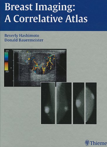 Breast Imaging: A Correlative Atlas