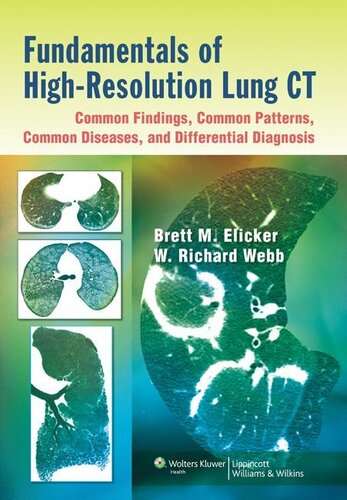 Fundamentals of High-Resolution Lung CT: Common Findings, Common Patters, Common Diseases and Differential Diagnosis: Common Findings, Common Patterns, Common Diseases, and Differential Diagnosis