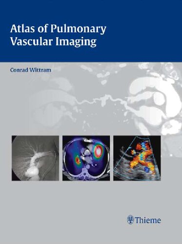 Atlas of Pulmonary Vascular Imaging (A Multimodality Approach)