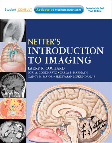 Netter's Introduction to Imaging: with Student Consult Access, 1e (Netter Basic Science)