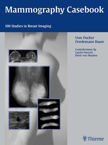 Mammography Casebook: 100 Studies in Breast Imaging