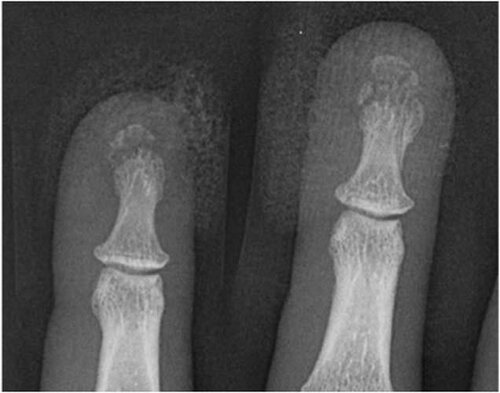 Broken Bones: The X-Ray Atlas of Fractures