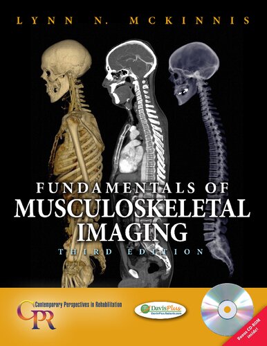 Fundamentals of Musculoskeletal Imaging (Contemporary Perspectives in Rehabilitation)