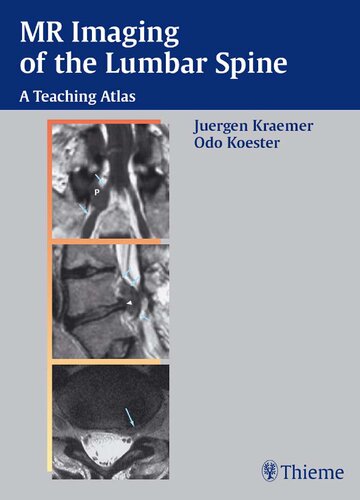 MR Imaging of the Lumbar Spine: A Teaching Atlas