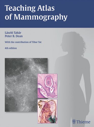 Teaching Atlas of Mammography (RÖFO-Ergänzungsbände)