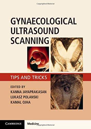 Gynaecological Ultrasound Scanning: Tips and Tricks