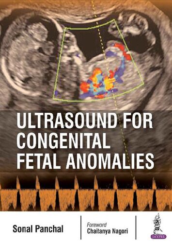 Ultrasound for Congenital Fetal Anomalies