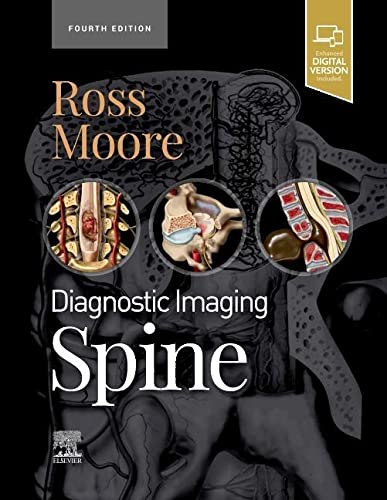 Diagnostic Imaging: Spine