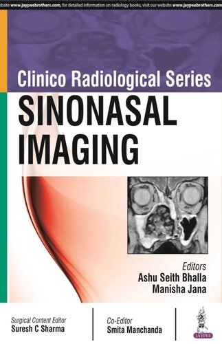 Clinico Radiological Series: Sinonasal Imaging