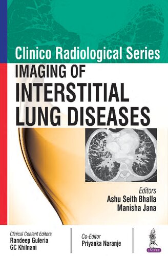 Clinico Radiological Series:Imaging Of Interstitial Lung Diseases