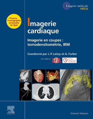 Imagerie cardiaque: Imagerie en coupes : scanner, IRM