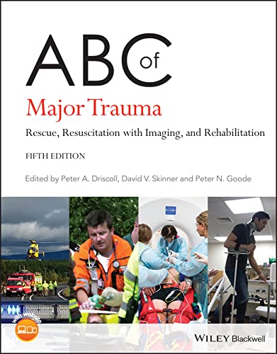 ABC of Major Trauma: Rescue, Resuscitation with Imaging, and Rehabilitation (ABC Series)