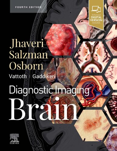 Diagnostic Imaging: Brain 4th Edition