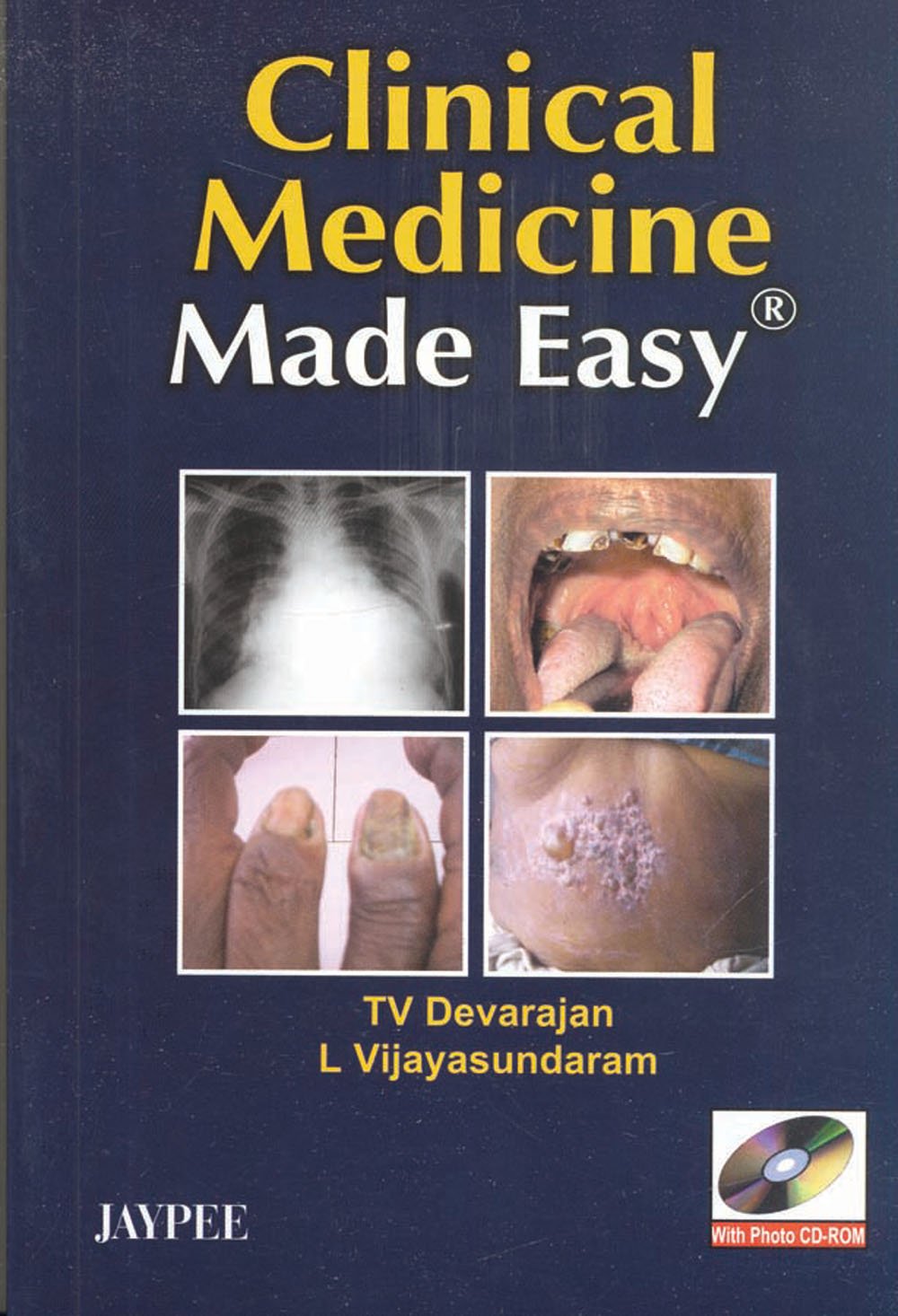 Clinical Medicine Made Easy