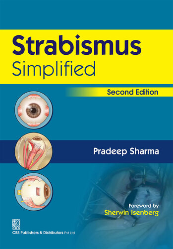 Strabismus Simplified