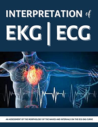 Interpretation of EKG | ECG: Illustrated Practical Guide For clinicians,interns,medical students or anyone in the health care profession to easily learn how To Read & Interpreting ECG EKG Strips