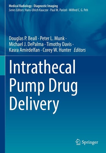 Intrathecal Pump Drug Delivery