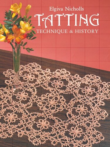 Tatting: Technique and History