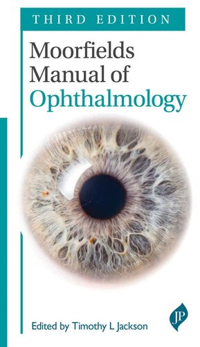 Moorfields Manual of Ophthalmology