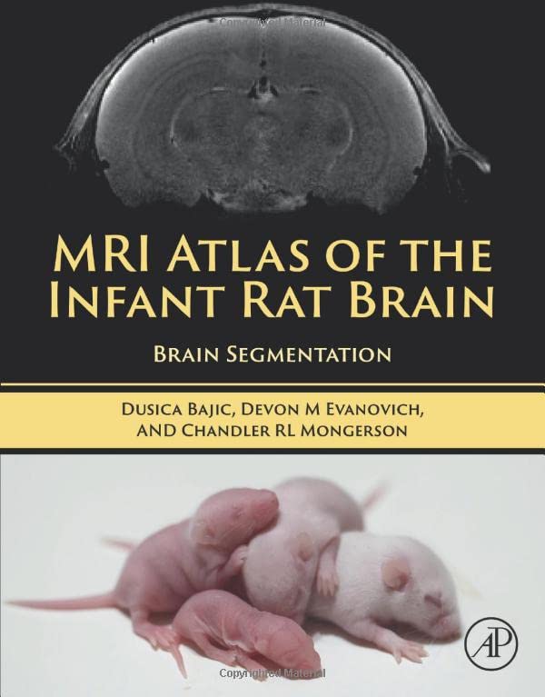 MRI Atlas of the Infant Rat Brain: Brain Segmentation