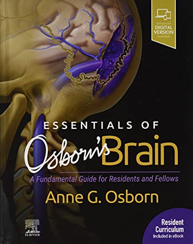 Essentials of Osborn's Brain: A Fundamental Guide for Residents and Fellows, 1e (2020)