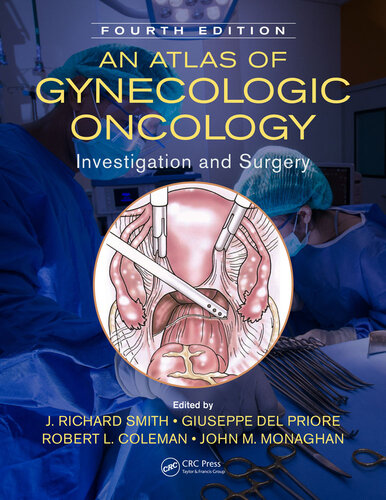 An Atlas of Gynecologic Oncology: Investigation and Surgery