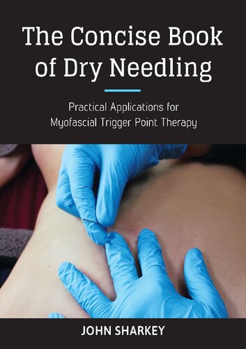 The Concise Book of Dry Needling