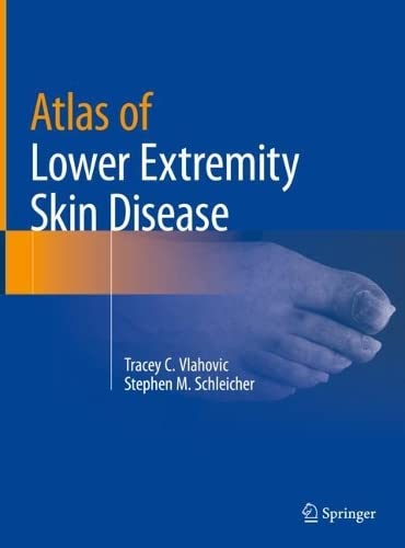 Atlas of Lower Extremity Skin Disease