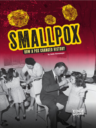 Smallpox: How a Pox Changed History