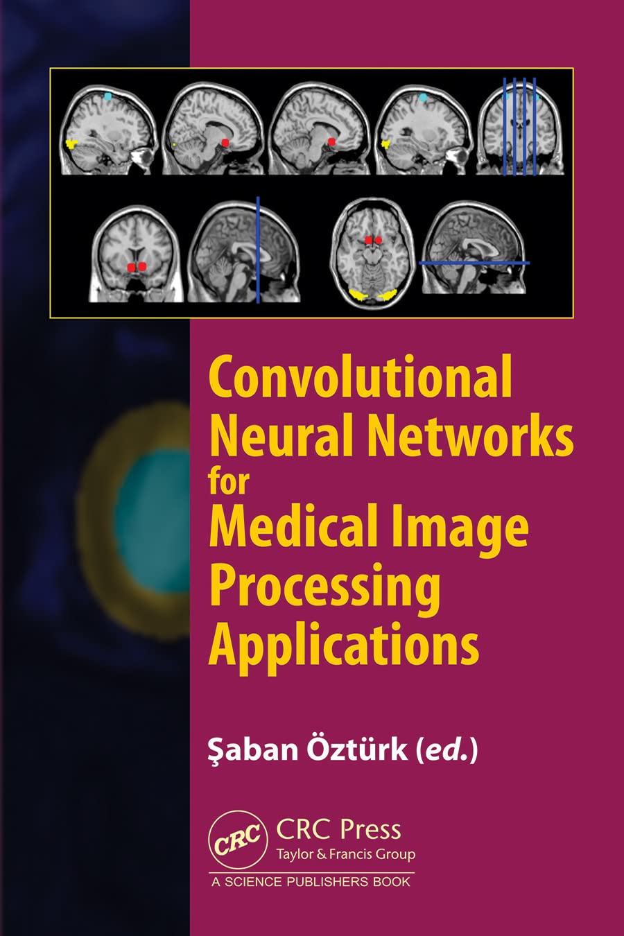 Convolutional Neural Networks for Medical Image Processing Applications