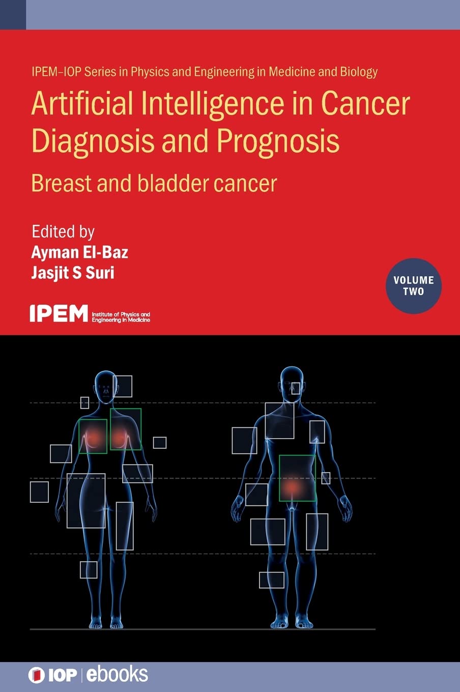 Artificial Intelligence in Cancer Diagnosis and Prognosis, Volume 2: Breast and bladder cancer