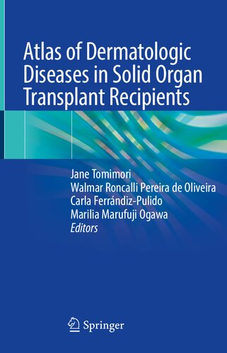 Atlas of Dermatologic Diseases in Solid Organ Transplant Recipients