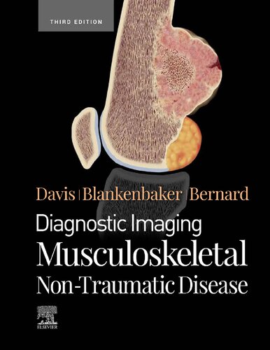 : Musculoskeletal Non-Traumatic Disease