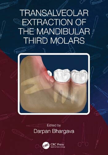 Transalveolar Extraction of the Mandibular Third Molars