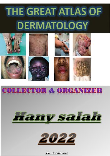 THE GREAT ATLAS OF DERMATOLOGY - Edit Book