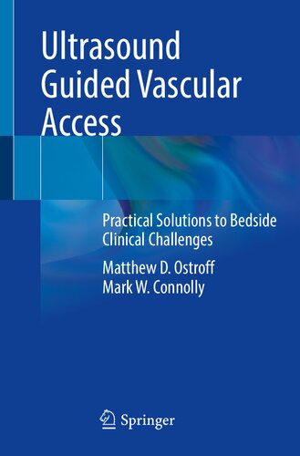 Ultrasound Guided Vascular Access: Practical Solutions to Bedside Clinical Challenges