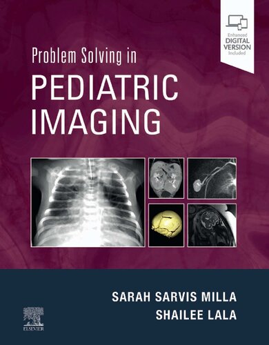 Problem Solving in Pediatric Imaging, 1e