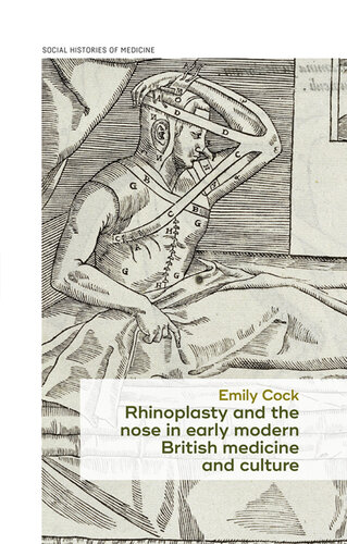 Rhinoplasty and the nose in early modern British medicine and culture