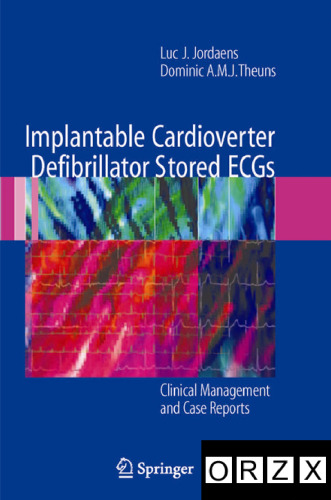 Implantable Cardioverter Defibrillator Stored ECGs: Clinical Management and Case Reports