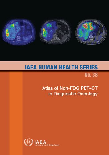 Atlas of Non-FDG PET–CT in Diagnostic Oncology