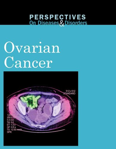 Ovarian Cancer