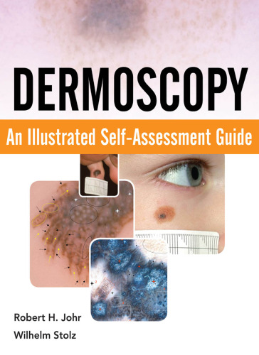 Dermoscopy: An Illustrated Self-Assessment Guide