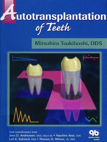 Autotransplantation of Teeth