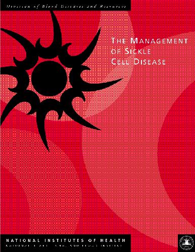 The Management of Sickle Cell Disease