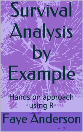 Survival Analysis by Example: Hands on approach using R