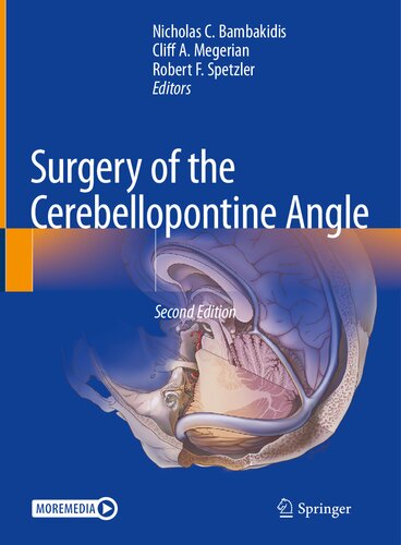 Surgery of the Cerebellopontine Angle