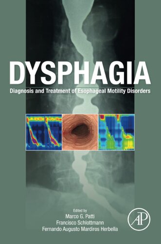 Dysphagia: Diagnosis and Treatment of Esophageal Motility Disorders